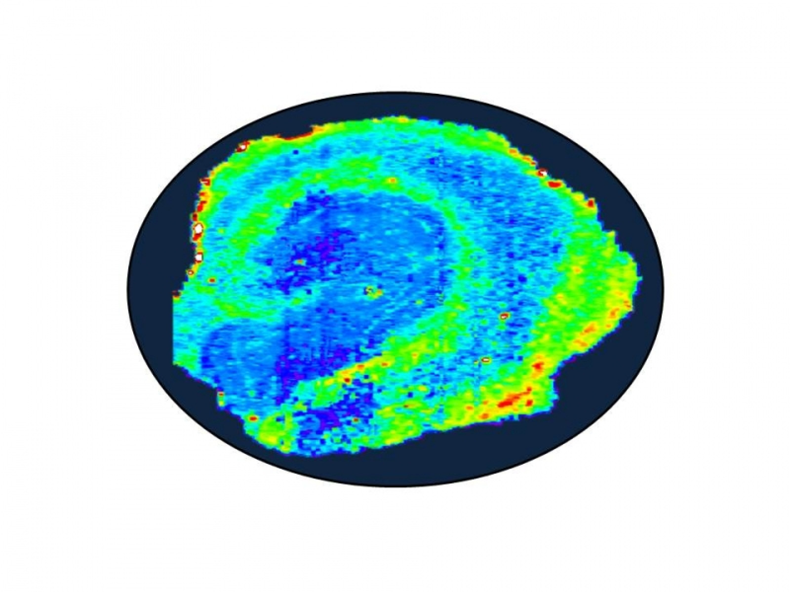 Advanced biometal imaging technology enhances dise...